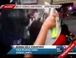 Burnu Bile Kanamadı