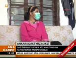 hatice nergis - Ankara'daki yüz nakli Videosu