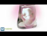 3 boyutlu goruntu - 3D Yazıcı ile Bebeğinizi Doğmadan Görün Videosu