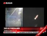 Sağ Eli Parçalandı