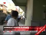 Karnındaki Bebeği Öldürmüş !