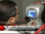 implant tedavisi - Sarı noktaya implant tedavisi Videosu