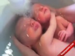 İkizler Hala Kendilerini Anne Karnında Sanıyorlar