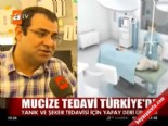 yanik tedavisi - Mucize tedavi Türkiye'de  Videosu