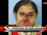 hatice nergis - Türkiye'nin tek kısmi yüz nakli  Videosu