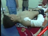 muhalifler - Suriye’de Çatışmalarda Yaralanan 13 Kişi Kilis'te  Videosu