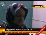 Dişlerini penseyle söktü  online video izle