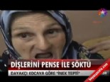 Dişlerini pense ile söktü 