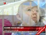 kizamik asisi - Kızamık vakası bini aştı  Videosu