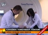 Kansere tomoterapi yönetimi 