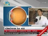 goz tedavisi - Türkiye'de ilk kez tek korneadan 2 hastaya nakil yapıldı Videosu