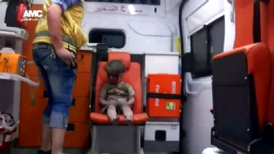 halepce katliami - Suriye Halep'teki yaralı çocuğun bakışları dünyanın içine işledi!  Videosu