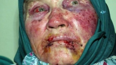 yasli kadin -  Yaşlı kadının darp ve gasp edilmesiyle ilgili 3 kişi gözaltına alındı  Videosu