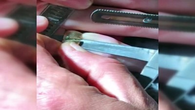 saglik ekipleri -  Parmağına sıkışan yüzüğü itfaiye ekipleri testereyle keserek çıkardı Videosu