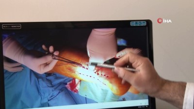  Türk doktoru aşil tendonu ameliyatı için yeni teknik geliştirdi