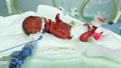 premature bebek - 285 gram doğdu, yaşama tutundu (2) - ŞIRNAK Videosu
