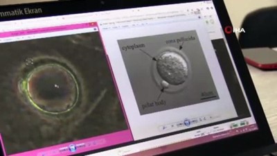 kok hucre -  Erken yumurtalık yaşlanmasına karşı çığır açacak çözüm...Yumurtalık kaynaklı yüzey kök hücreleri kullanılarak öncü yumurta hücreleri elde edilecek  Videosu