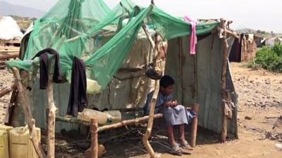 insani kriz - Yemenli babaların tek hayali çocuklarına yiyecek götürebilmek - SANA  Videosu