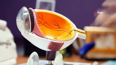 hipermetrop -  Akıllı lens ile gözlüğe son  Videosu