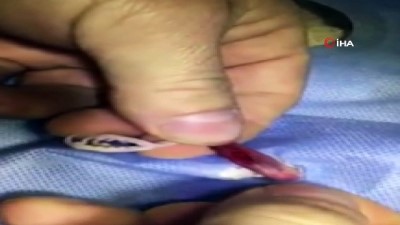 muhabbet kusu -  Sağ ayağı kırılan muhabbet kuşuna pim takıldı  Videosu