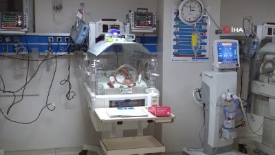 dusunur -  Kalbi göbeğinde olan bebek herkesi şaşırttı  Videosu