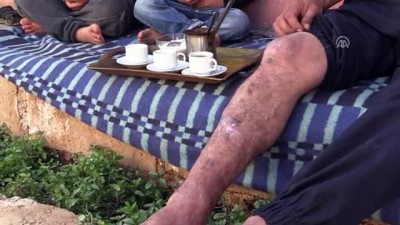 engelli cocuk - Suriye'de savaşın engellere mahkum ettiği siviller destek bekliyor (2) - İDLİB  Videosu