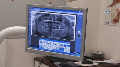 dis hekimi -  Operasyon var demediler Kırıkhan'a diş tedavisine geldiler  Videosu