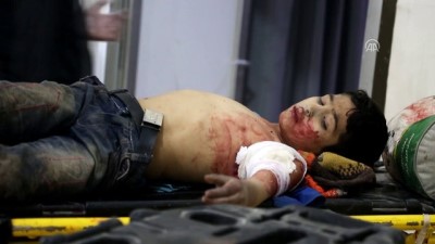 rejim - Esed rejiminin aralıksız bombardımanlarında çok sayıda çocuk yaralandı - DOĞU GUTA  Videosu