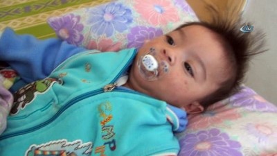 dogus -  Doğuştan makatı olmayan bebek yaşam mücadelesi veriyor  Videosu