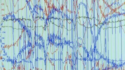 Epilepside 'nöbet' uyarısı - İZMİR 