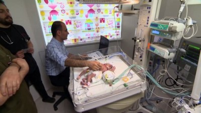 ikiz bebekler - Ameliyatla ayrılan Suriyeli siyam ikizlerinden biri öldü - KONYA  Videosu