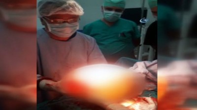 ayetler -  Karnından 7,5 kiloluk dev kist çıkarıldı Videosu