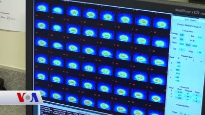 rontgen - Akıl Hastalıkları Tedavisinde Beyin Taraması  Videosu