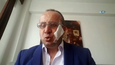 icra memuru -  Borçlu icra takibi yapan avukatın yanağını ısırarak kopardı Videosu