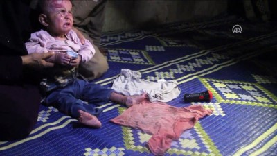 hastalik - 'Oğlum insanın katlanamayacağı acılar çekiyor' - İDLİB  Videosu