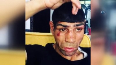 bicakli saldiri -  Zihinsel engelli gence bıçaklı saldırı Videosu