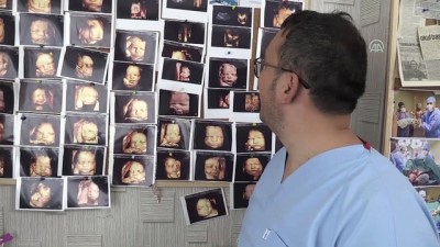 baglilik - Ultrason fotoğraflarından koleksiyon yaptı - KAYSERİ  Videosu