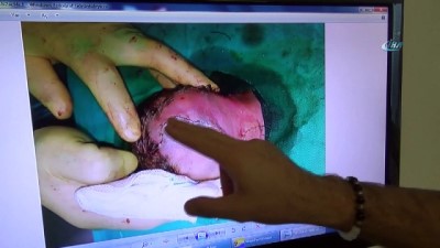 beyin dokusu -  Yeşil sahaların doktor hakemi 3 günlük bebeği hayata bağladı  Videosu