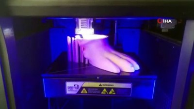 uc boyutlu yazici -  Kocabaş 3 boyutlu yazıcı ile yapılan protez bacakla yeniden yürüdü Videosu