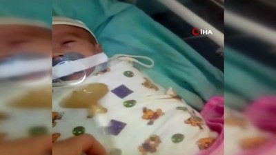 solunum cihazi -  - Rusya'da Kuvözdeki Bebeğe Emzik İşkencesi  Videosu