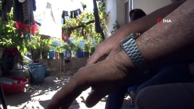 yerli ilac -  'Balık pulu' hastalığı vatandaşların kabusu oldu Videosu