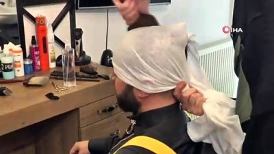 kellik -  Protez saç işlemi yaptırdı hayatı değişti Videosu