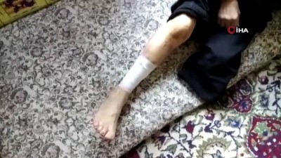  Bir bacağı kesilen ve vücudunda yaralar çıkan şeker hastası adam yardım bekliyor 