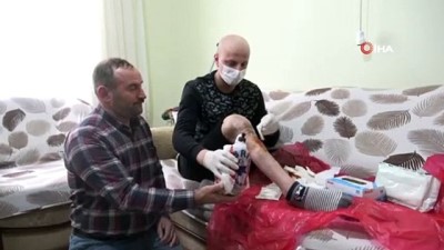 doku kanseri -  210 bin lira bulamazsa bacağı kesilecek  Videosu