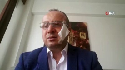 doktora saldiri -  Avukatın yanağını ısıran sanık hakim önünde  Videosu