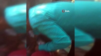 gesi -  - Kafası tencereye sıkışan küçük kızı kurtarma operasyonu  Videosu