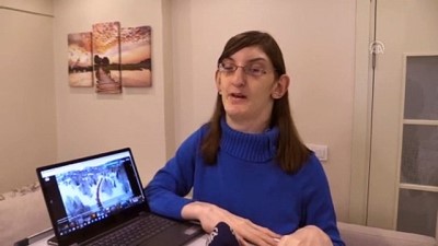 hain saldiri - Dünyanın en uzun genç kızı AA'nın 'Yılın Fotoğrafları' oylamasına katıldı - KARABÜK  Videosu