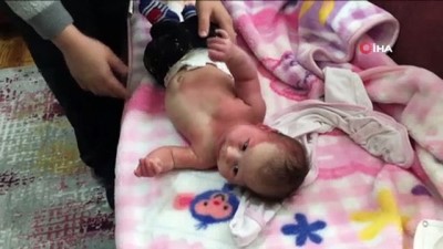 lazer tedavisi -  Doğuştan 'Sturge Weber' hastalığı olan 40 günlük Hira bebek tedavi için destek bekliyor  Videosu