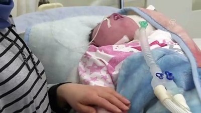 Anensefali hastası bebek azmiyle doktorları bile şaşırtıyor (1) - ANKARA