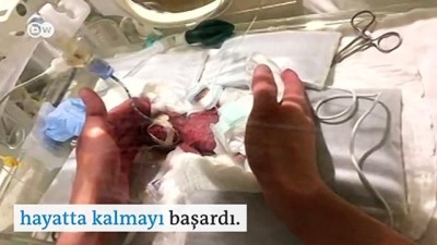 bebek - 268 gramlık bebek artık hastaneden taburcu oldu Videosu